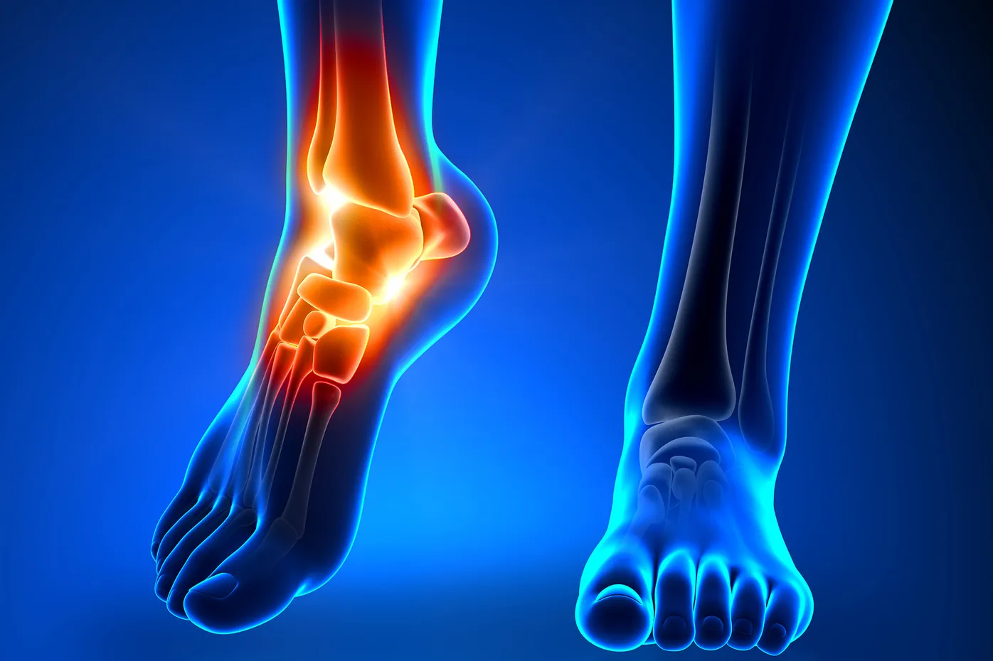 Common Causes and Treatments for a Sprained Ankle