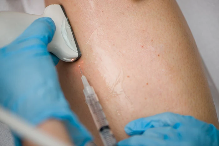 Understanding the Services Provided by Your Local Vein Clinic