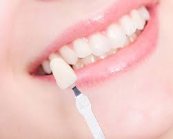 How Dental Crowns Can Help Your Smile