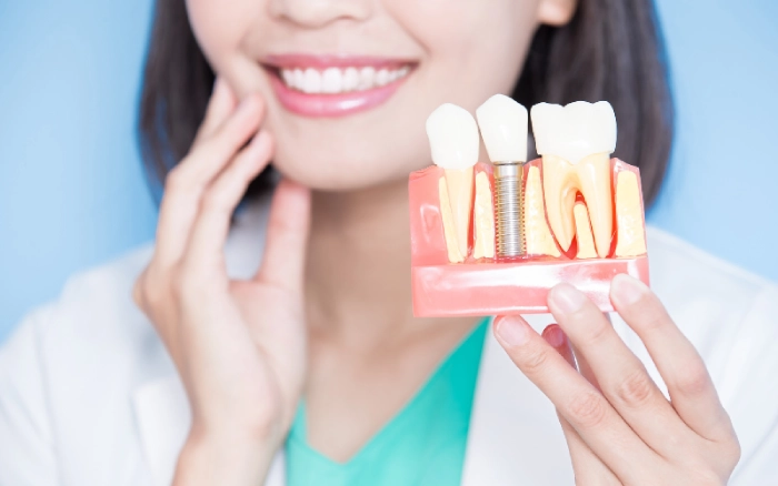 The Role of Dental Implants in Restoring Your Smile